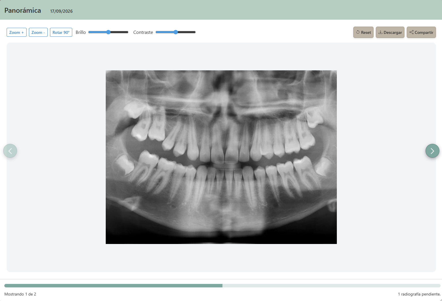 Radiografía panorámica abierta en el visor clínico